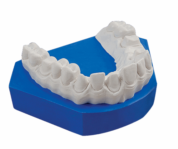 gypsum resins